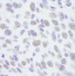 Detection of mouse SAFB1 by immunohistochemistry.