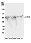 Detection of human and mouse DLD by western blot.