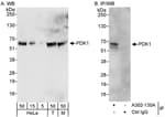 Detection of human and mouse PDK1 by western blot (h&amp;m) and immunoprecipitation (h).