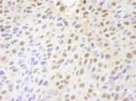 Detection of mouse PARP10 by immunohistochemistry.