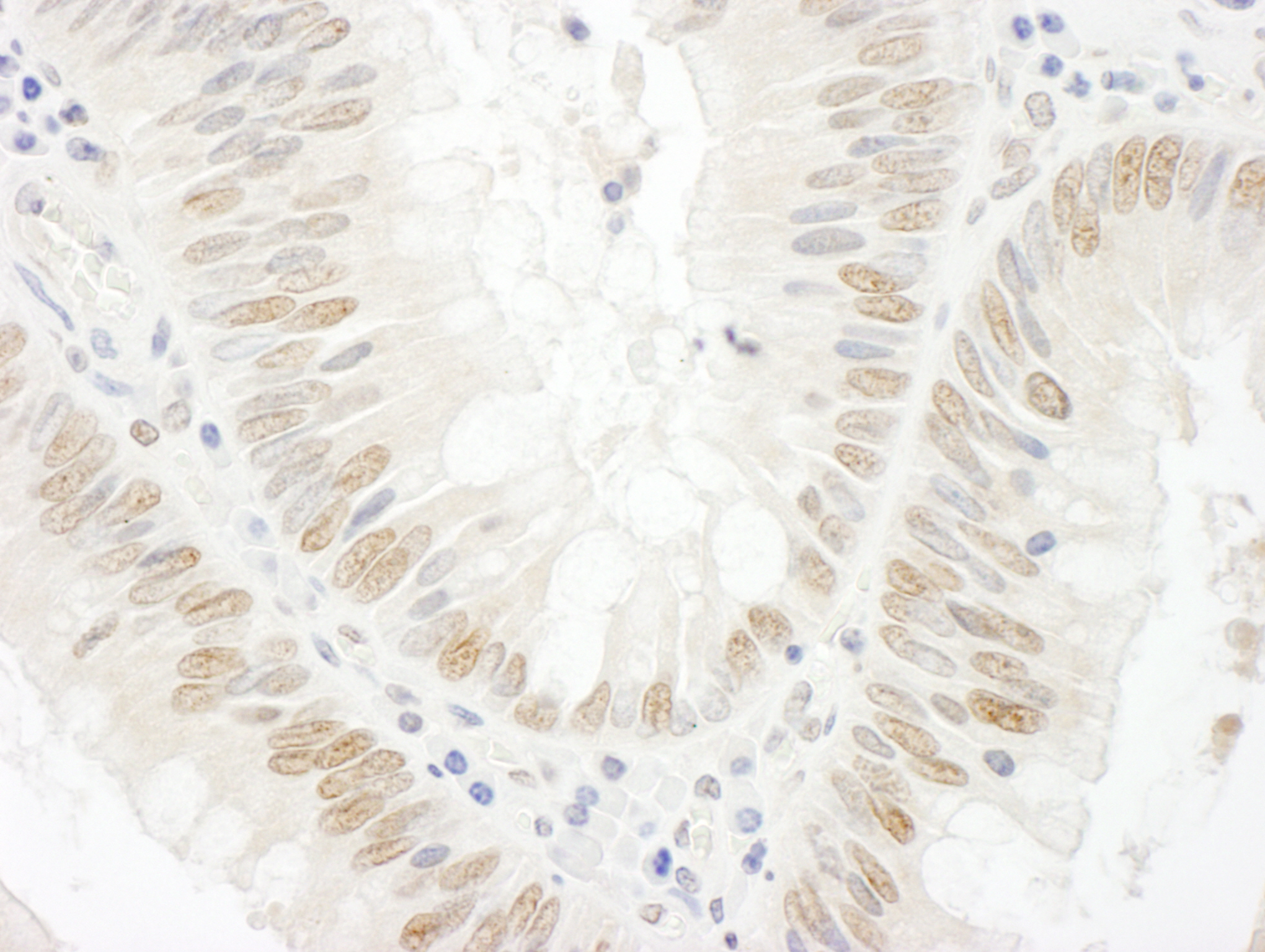 Detection of human BCCIP by immunohistochemistry.