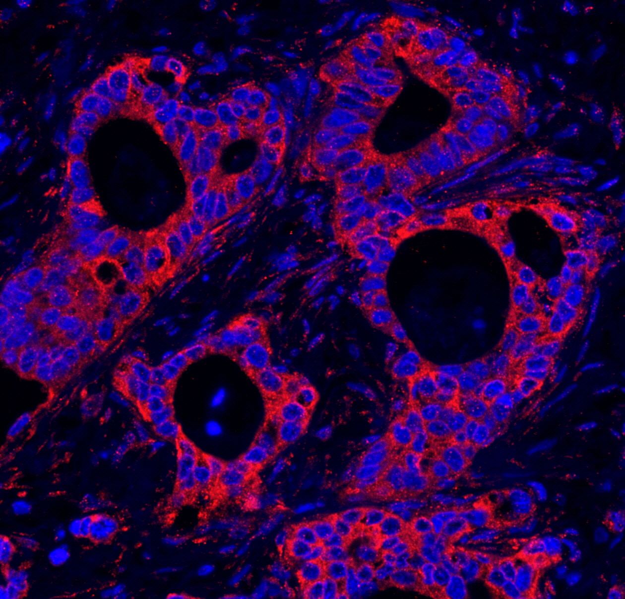 Detection of human HPIP by IHC-IF.