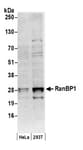 Detection of human RanBP1 by western blot.