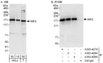 Detection of human INF2 by western blot and immunoprecipitation.