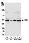 Detection of human KRR1 by western blot.