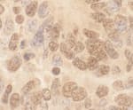 Detection of mouse Cul2 by immunohistochemistry.