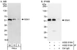 Detection of human SSA1 by western blot and immunoprecipitation.