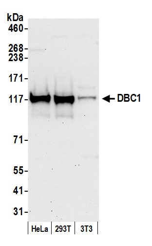 Detection of human and mouse DBC1 by western blot.