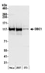 Detection of human and mouse DBC1 by western blot.