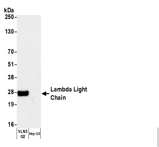 Rabbit anti-Human Lambda Light Chain Antibody Affinity PurifiedBethyl Laboratories