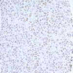 Detection of mouse EDD1 by immunohistochemistry.