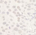 Detection of mouse HDAC3 by immunohistochemistry.