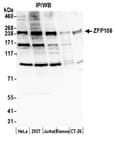 Detection of human and mouse ZFP106 by western blot.