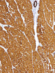 Detection of human alpha Skeletal Muscle Actin by immunohistochemistry.