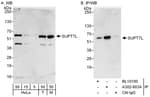 Detection of human and mouse SUPT7L by western blot (h&amp;m) and immunoprecipitation (h).