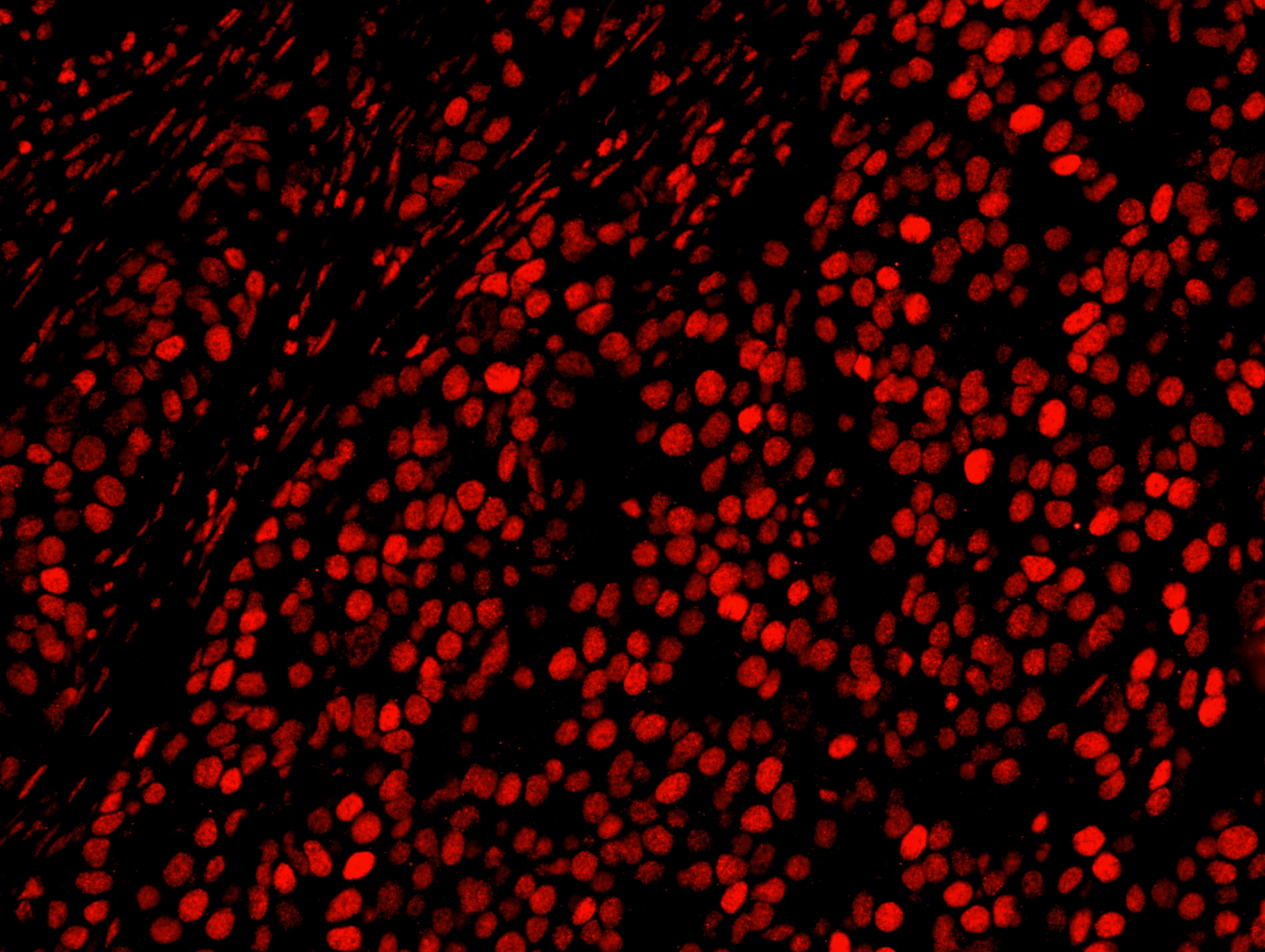 Rabbit anti-AKAP8L/HA95 IHC Antibody