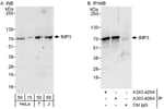 Detection of human IMP3 by western blot and immunoprecipitation.
