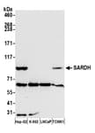 Detection of human and mouse SARDH by western blot.