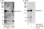 Detection of human ANKS1A by western blot and immunoprecipitation.