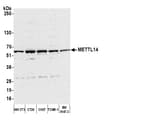 Detection of mouse METTL14 by western blot.