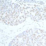 Detection of human SUPT6H by immunohistochemistry.