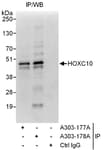 Detection of human HOXC10 by western blot of immunoprecipitates.