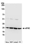 Detection of human and mouse eIF4E by western blot.