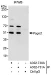 Detection of human Pygo2 by western blot of immunoprecipitates.