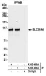 Detection of human SLC39A6 by western blot of immunoprecipitates.
