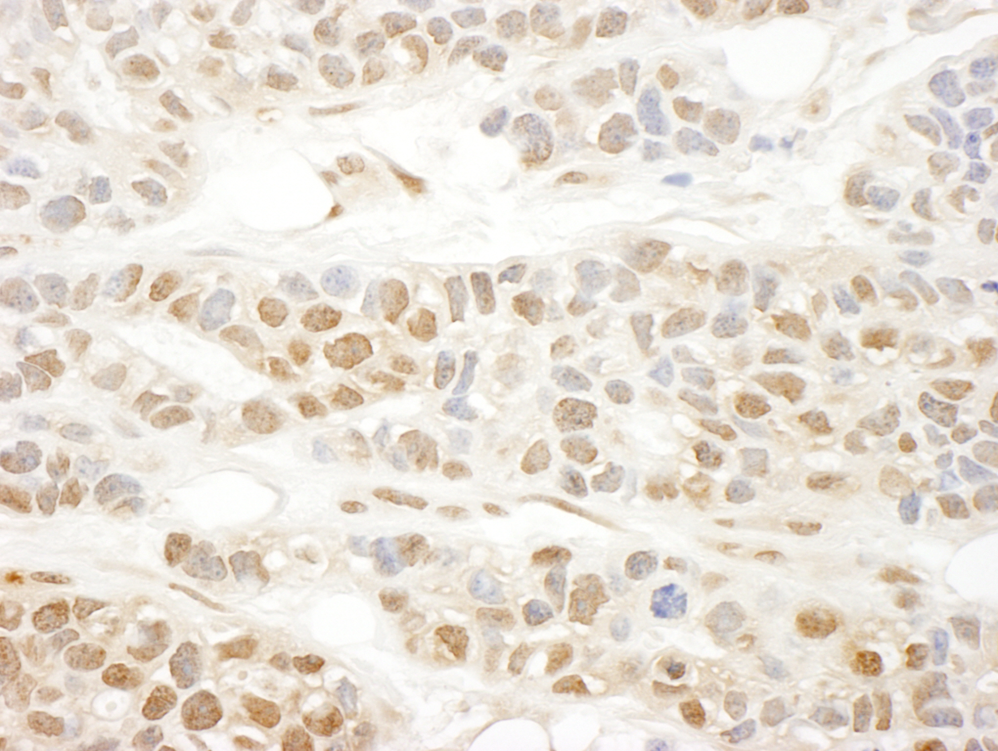 Rabbit anti-MKL1 IHC Antibody