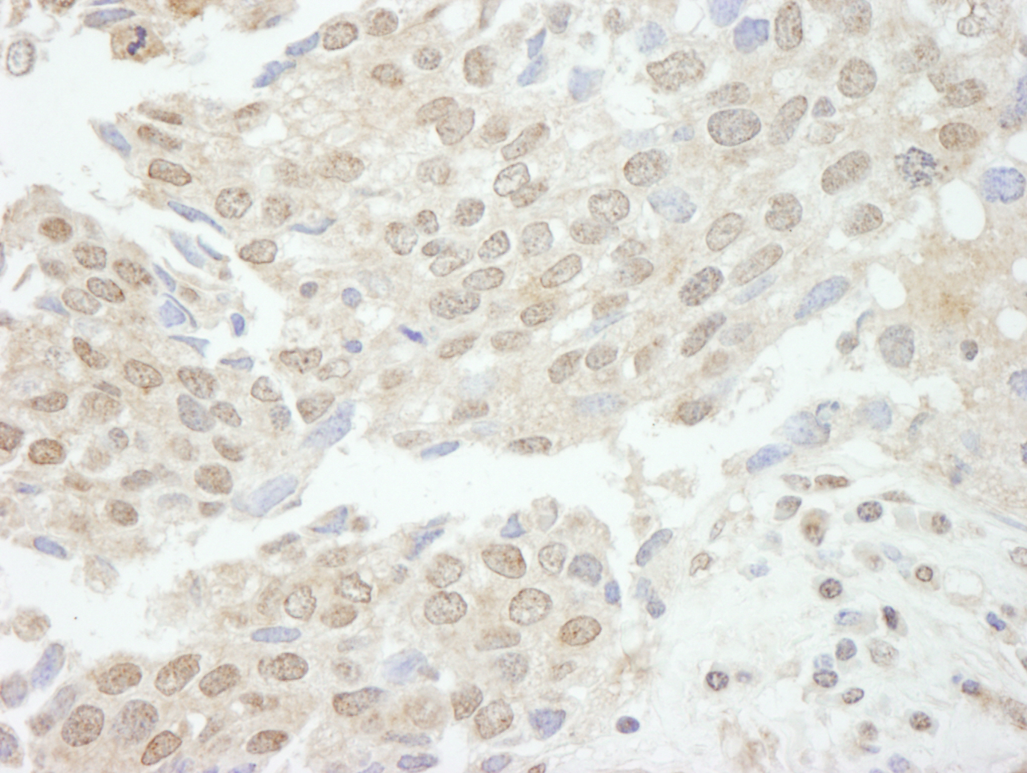 Rabbit anti-TDP1 IHC Antibody