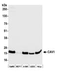 Detection of human CAV1 by western blot.