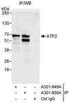 Detection of human ATF2 by western blot of immunoprecipitates.