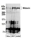 Detection of human Midasin by western blot.