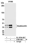 Detection of human Doublecortin by western blot of immunoprecipitates.