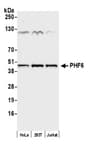 Detection of human PHF6 by western blot.