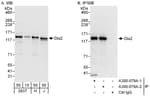 Detection of human Diaphanous 2 by western blot and immunoprecipitation.