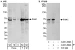 Detection of human and mouse PAK1 by western blot (h&amp;m) and immunoprecipitation (h).