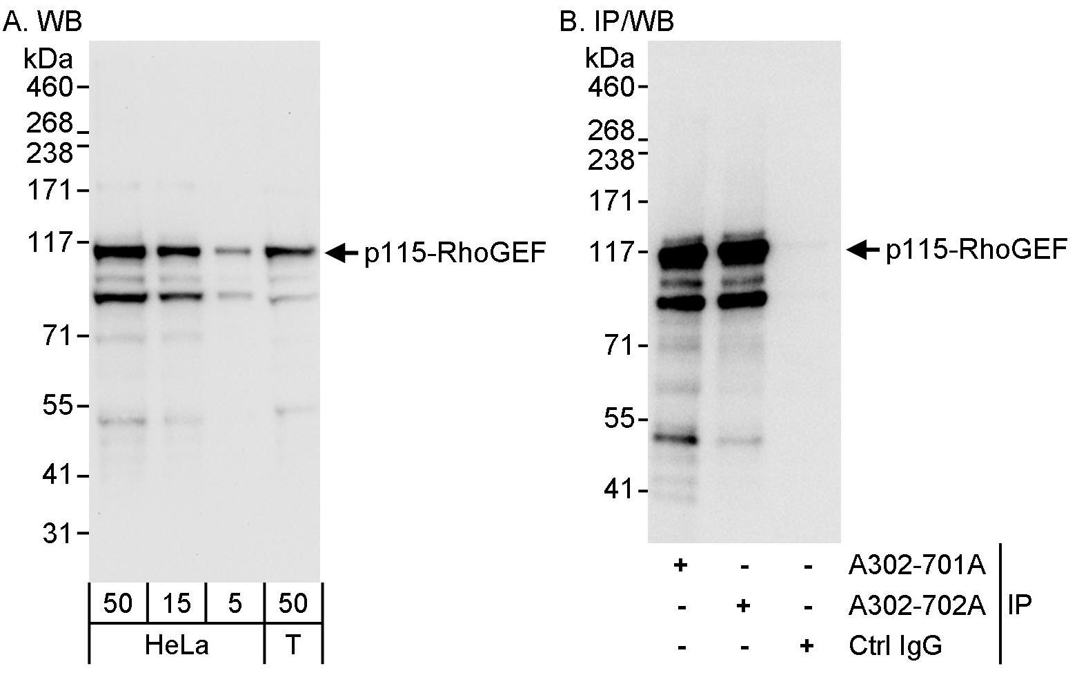 Detection of human p115-RhoGEF by western blot and immunoprecipitation.