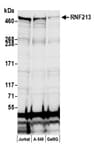 Detection of human RNF213 by western blot.