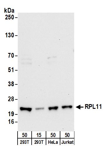 Detection of human RPL11 by western blot.