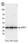 Detection of human HPRT1 by western blot.