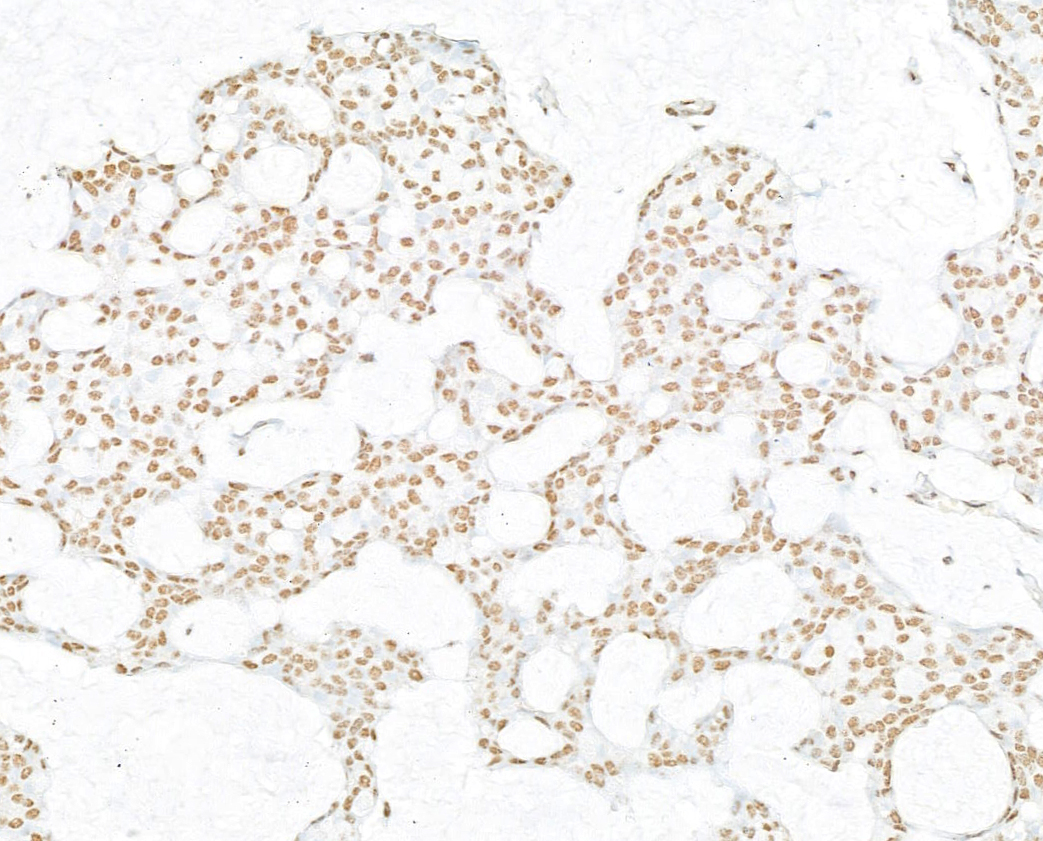Detection of human NONO by immunohistochemistry.