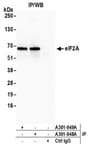 Detection of human eIF2A by western blot of immunoprecipitates.