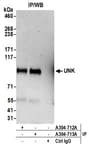 Detection of human UNK by western blot of immunoprecipitates.