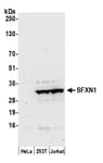 Detection of human SFXN1 by western blot.
