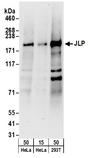 Detection of human JLP by western blot.