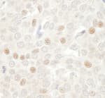 Detection of Human CDC20 by Immunohistochemistry.
