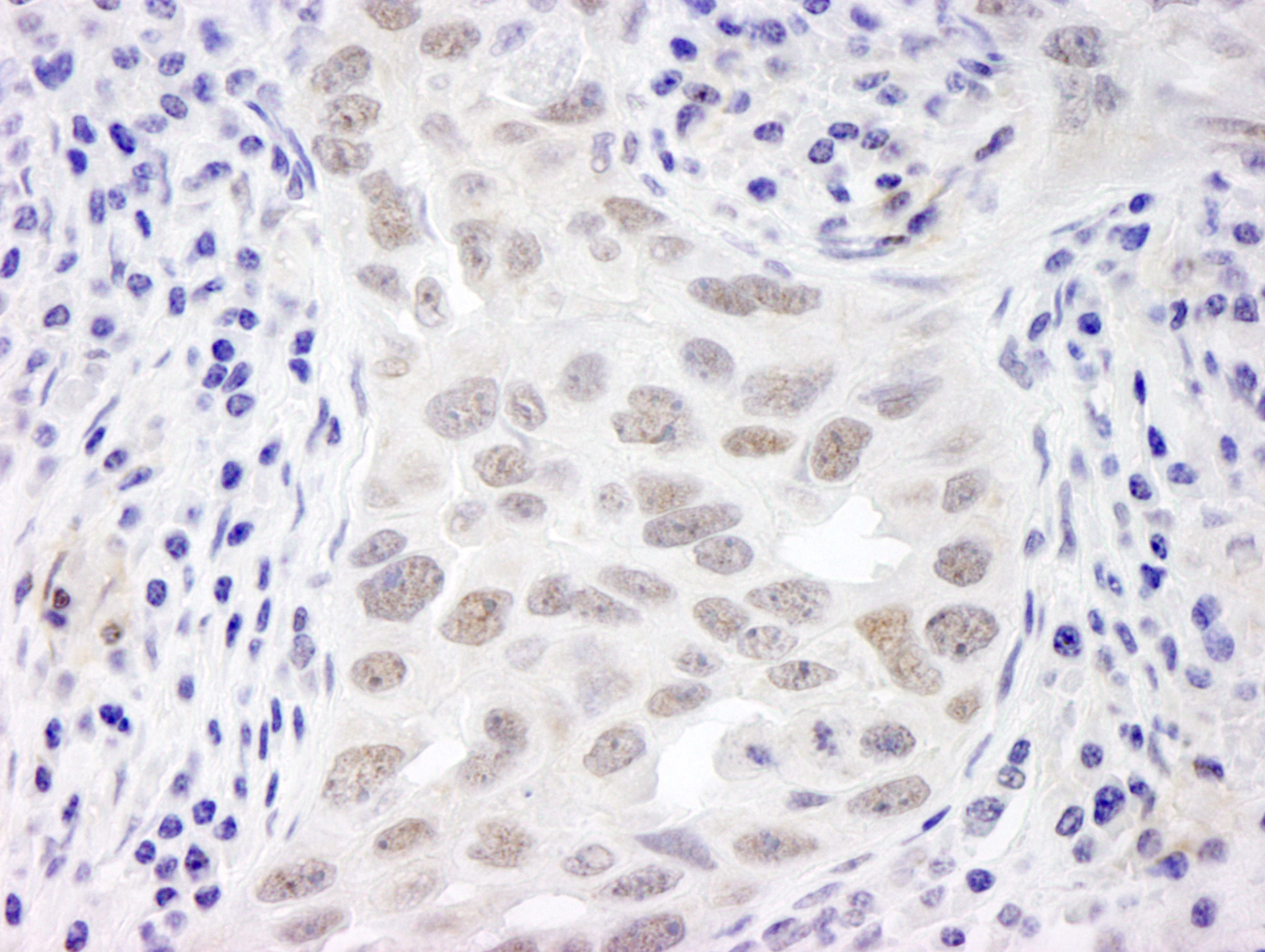 Rabbit anti-EMSY IHC Antibody