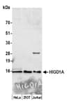Detection of human HIGD1A by western blot.